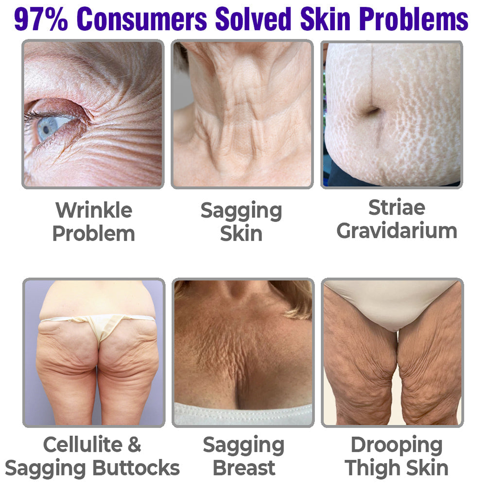 flysmus™ Firmaluxe Intensive Tightening Lotion 🇺🇸 FDA Approved
