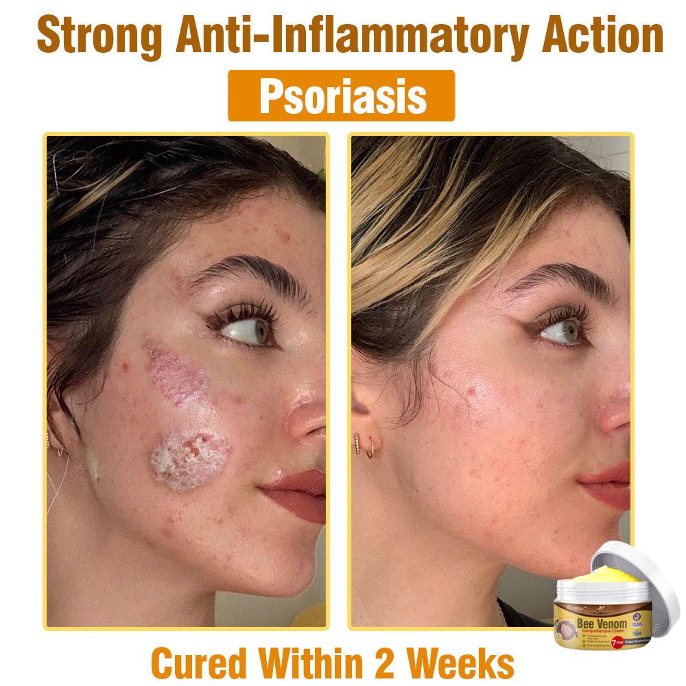 🍀 flysmus™ Bee Venom Comprehensive Cream 🇺🇸 Dermatologist Recommended