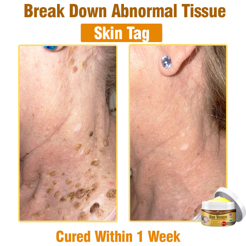 🍀 flysmus™ Bee Venom Comprehensive Cream 🇺🇸 Dermatologist Recommended