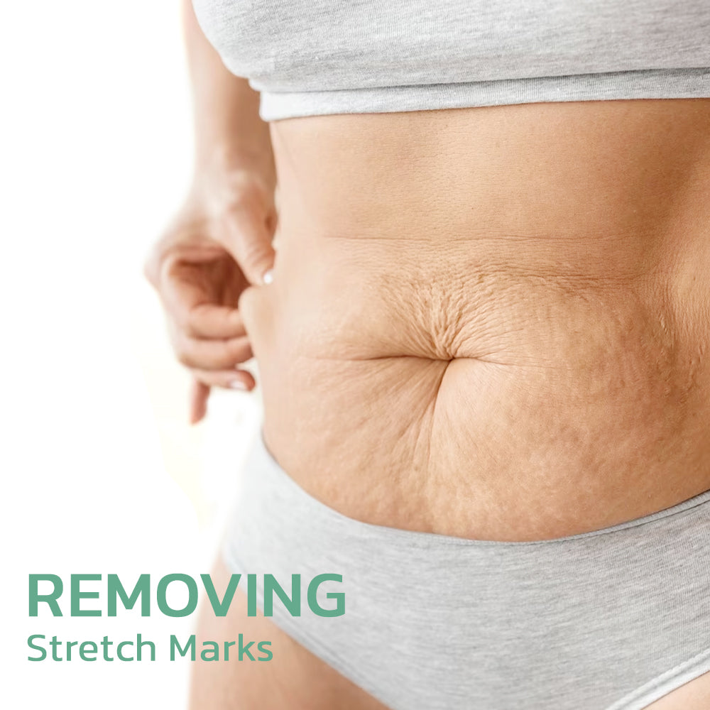 flysmus™ BewtyMax Collagen Lifting Body Oil