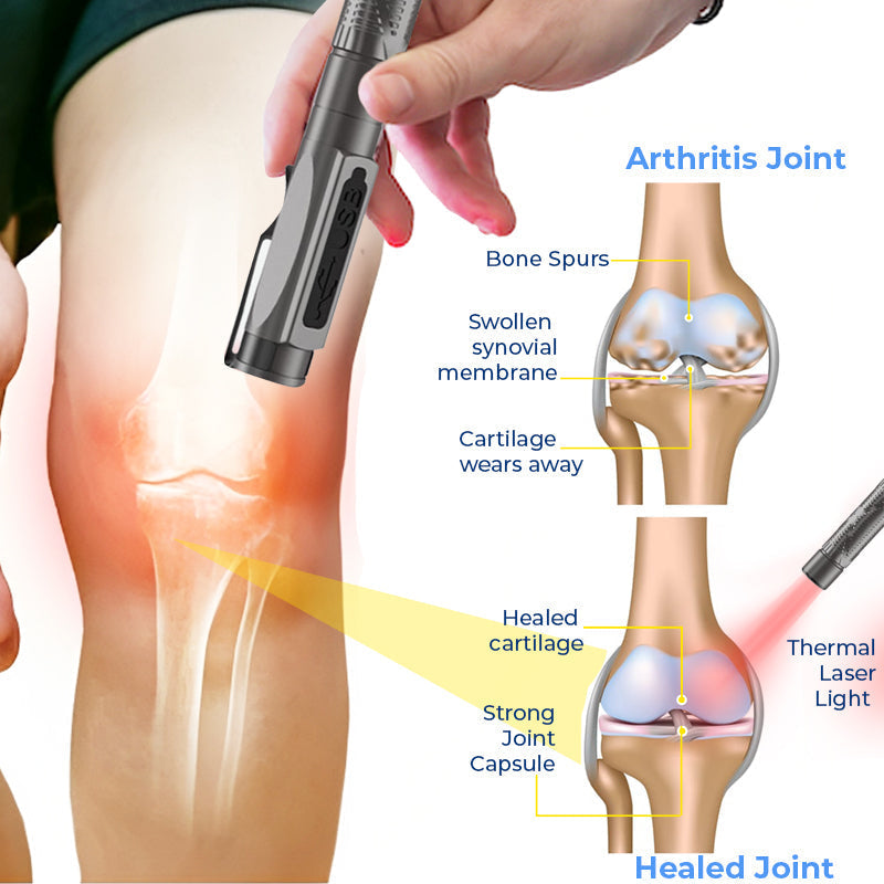 GFOUK™ MedicWave Thermal Laser Joint Care Pen