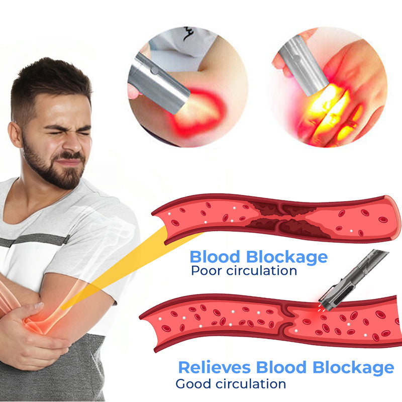 GFOUK™ MedicWave Thermal Laser Joint Care Pen