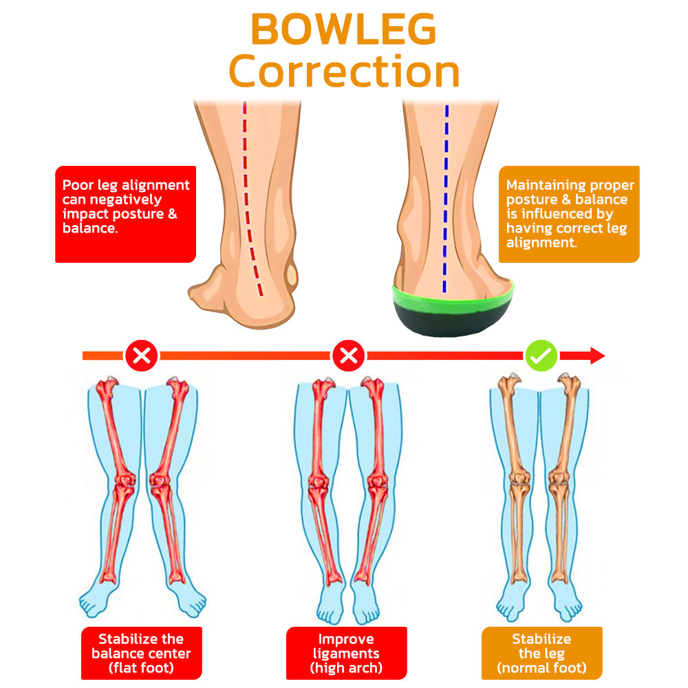 GFOUK™ BowlegOut Tourmaline Alignment Calcium Insoles