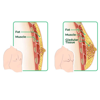 GFOUK™ GynoReduct Gynecomastia Diminishing Patch