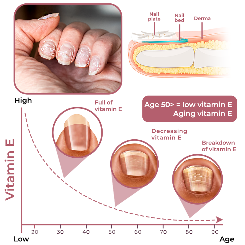 GFOUK™ Peeling Nail Therapy Vitamin E Serum