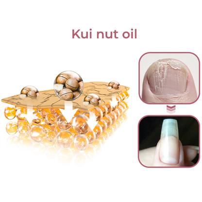 GFOUK™ Peeling Nail Therapy Vitamin E Serum