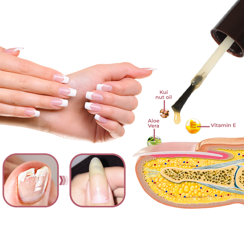 GFOUK™ Peeling Nail Therapy Vitamin E Serum